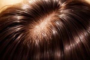 cuir-chevelu-nourri-cheveux-brillants