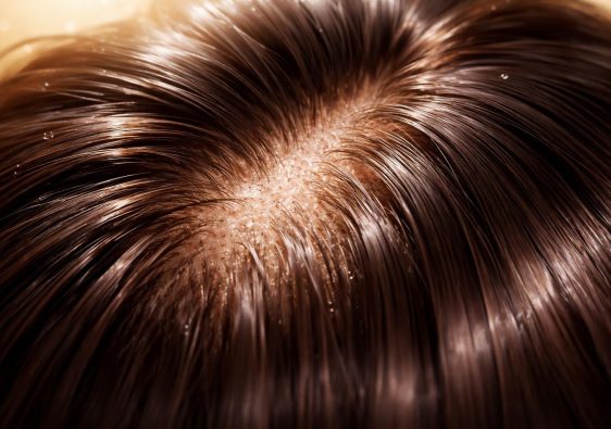 cuir-chevelu-nourri-cheveux-brillants