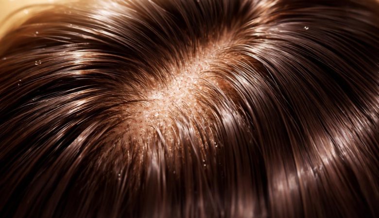 cuir-chevelu-nourri-cheveux-brillants